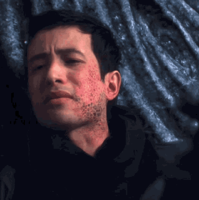 a man with spots on his face is laying down
