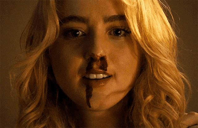 a woman with blood on her nose and mouth