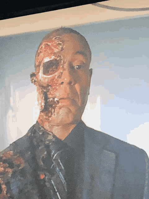 a man in a suit and tie has a burned eye