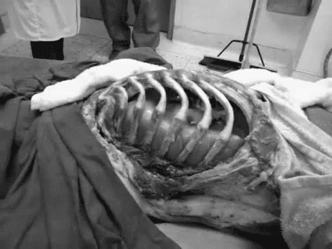 Science Cadaver GIF - Science Cadaver Lungs GIFs