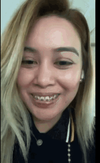 a woman with braces on her teeth smiles at the camera