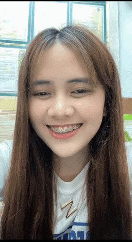 a girl with braces on her teeth is smiling and wearing a shirt with the letter z on the front