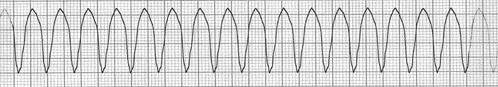 a graph of a wave on a graph paper .