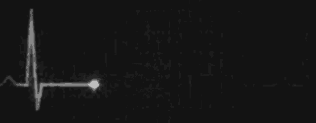 a heartbeat line on a black background with a light coming out of it
