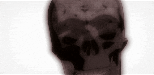 an x-ray of a skull with a white background
