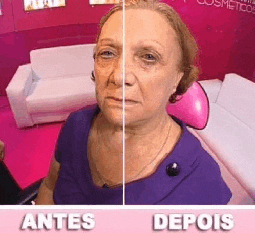 a woman is sitting in front of a pink couch and a before and after picture of her face .