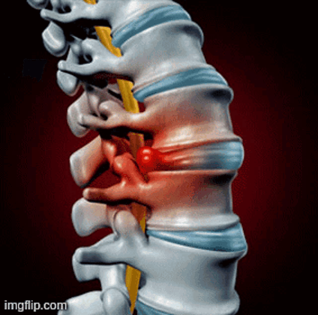 a computer generated image of a spine with a red circle in the middle