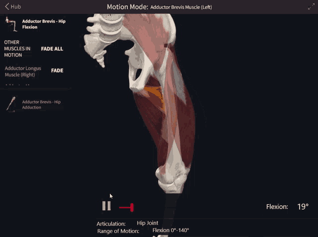 a computer screen shows the adductor brevis muscles