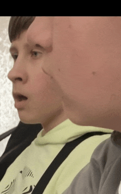 a close up of a person 's face with a very large head .