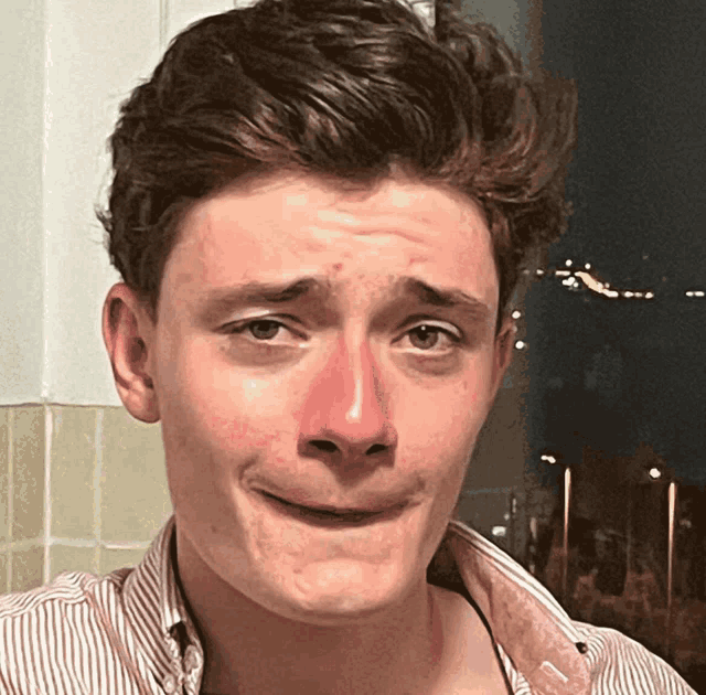 a young man with a red nose and a striped shirt