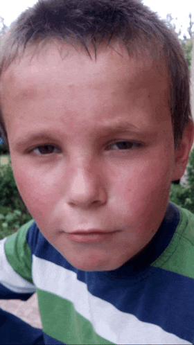 a close up of a young boy 's face with a red spot on his forehead