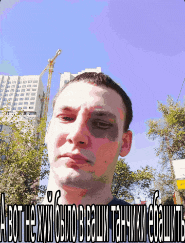 a man with a black eye is standing in front of a blue sky and trees