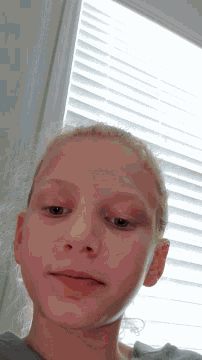 a girl with a black spot on her eye looks at the camera