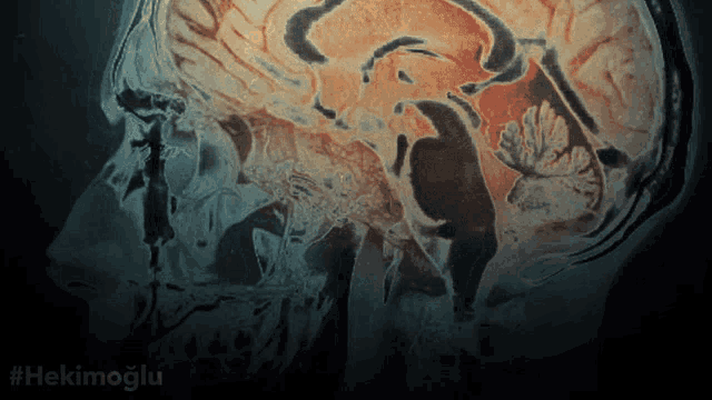 a close up of a brain with the hashtag #hekimoglu on the bottom