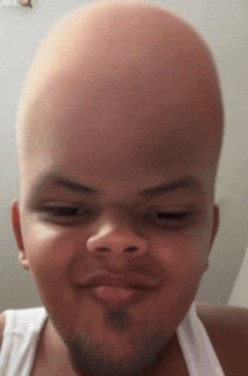 a bald man with a beard is making a funny face with his head in the air .