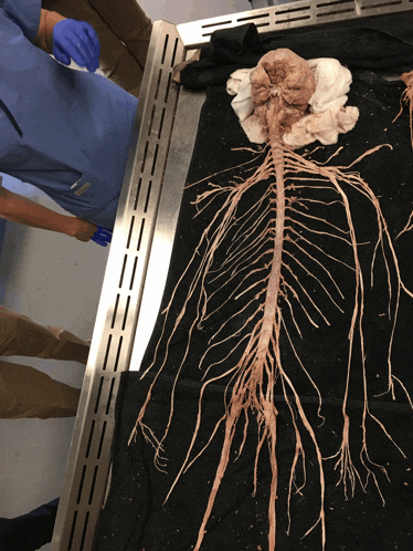a skeleton is laying on a black cloth with a person standing behind it