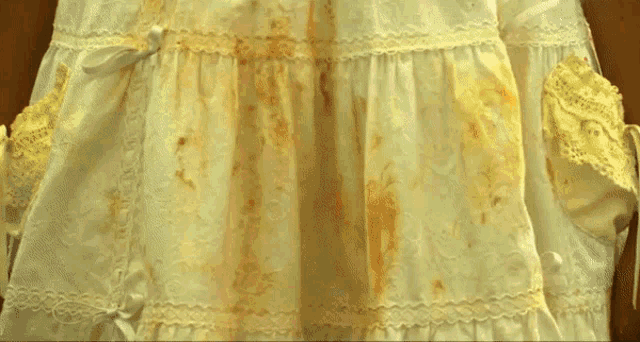 a white cloth with a lot of blood stains on it
