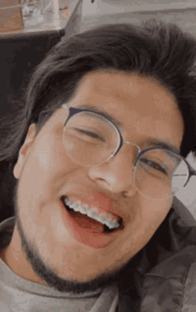 a young man with glasses and braces on his teeth is smiling