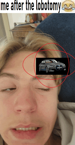 a woman with her eyes closed has a picture of a car on her forehead with the caption " me after the lobectomy "