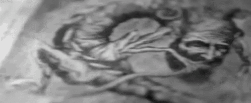 it is a black and white painting of a man with a beard and a strange face .