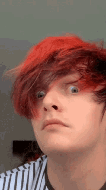 a young man with red hair and a striped shirt is making a funny face