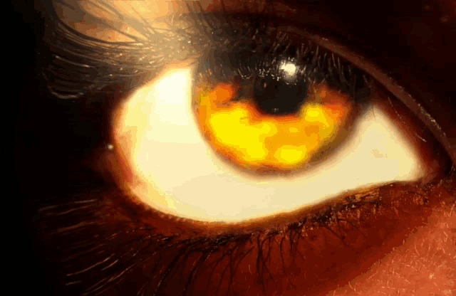 a close up of a person 's eye with a yellow glow in it