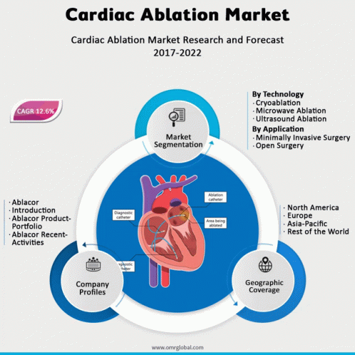 Cardiac Ablation Market GIF - Cardiac Ablation Market GIFs