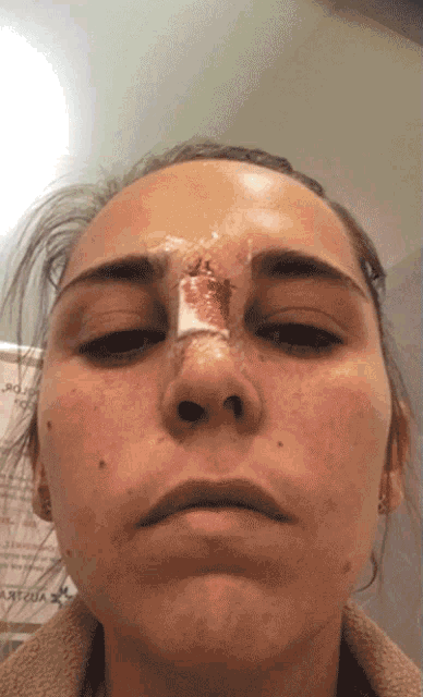 a close up of a woman 's face with a bandage on it