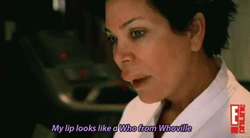 My Lip Looks Like A Who From Whoville GIF - Botox Lip Who GIFs