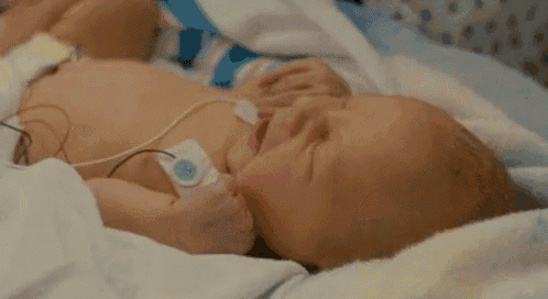 a baby is laying in a hospital bed with an oxygen mask on his chest .