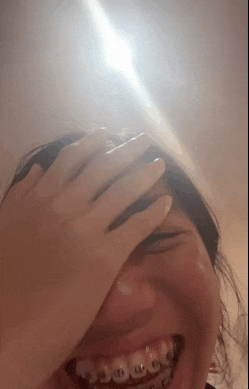 a woman with braces on her teeth covering her face with her hand