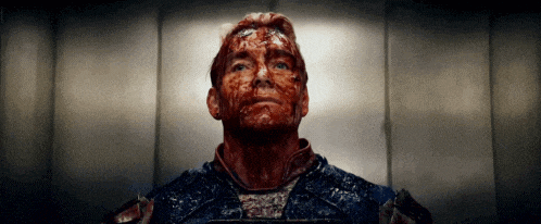 a man with blood on his face looking up