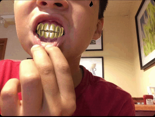 a boy with a gold grill on his teeth