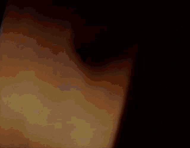 a close up of a person 's arm in a dark room .