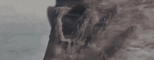 a close up of a person 's skull with a broken jaw .