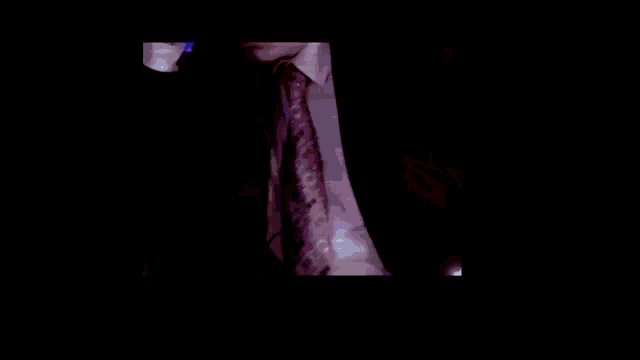 a man in a suit and tie holds his head in his hand