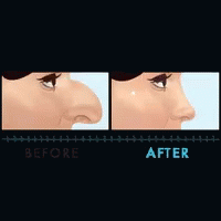Plastic Surgery Beauty GIF - Plastic Surgery Beauty Medicine GIFs