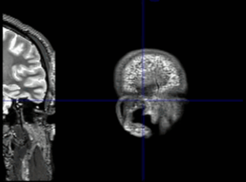 Human Brain Mri Gif Brain Gif GIF - Human Brain Mri Gif Brain Mri Gif Brain Gif GIFs