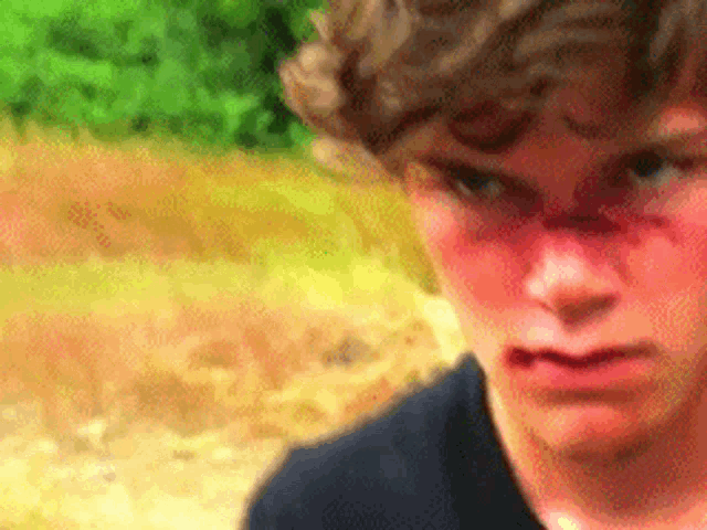 a close up of a young man with a red face