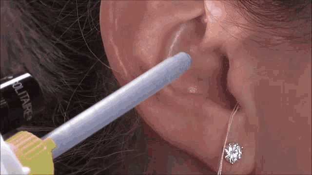 Ear Impression Earmold GIF - Ear Impression Earmold Hearing Aid GIFs