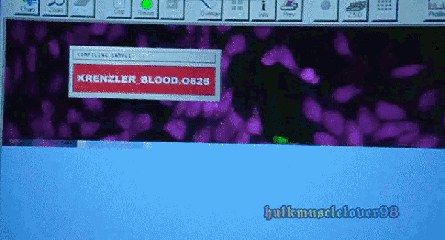a computer screen shows krenzler blood .626 on it
