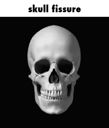 Skull Fissure GIF - Skull Fissure Skill GIFs