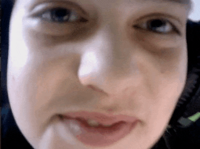 a close up of a woman 's face with dark circles under her eyes and a smile on her face .