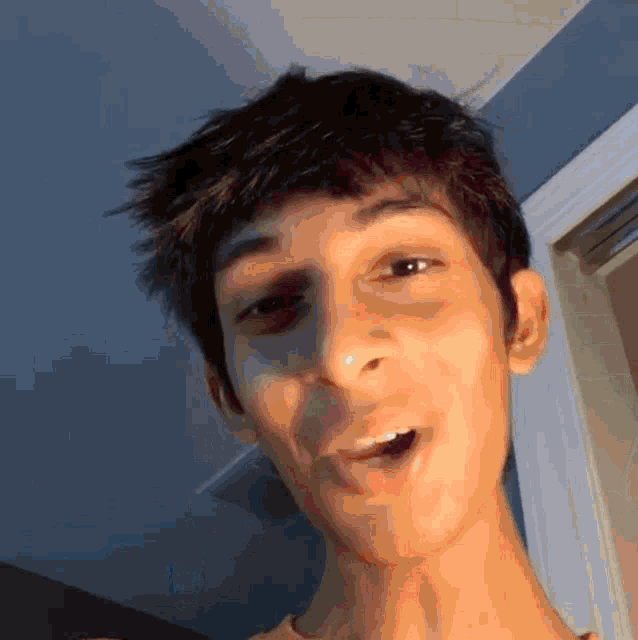 a young man with a black eye is making a funny face with his mouth open