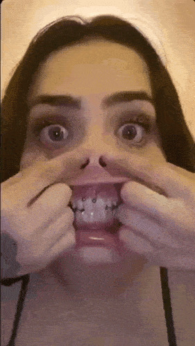 a woman with braces on her teeth is making a funny face with her hands .