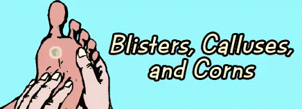 Blister GIF - Blister Corns Calluses GIFs