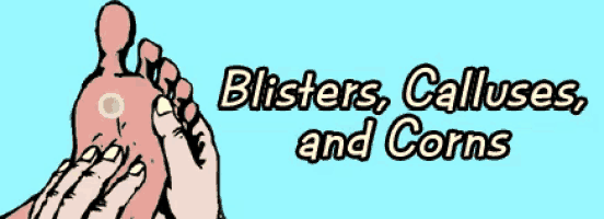 a cartoon drawing of a person 's foot with the words blisters calluses and corns above it