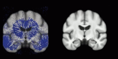 Brain Brain Images GIF - Brain Brain Images Cerebral Cortex GIFs