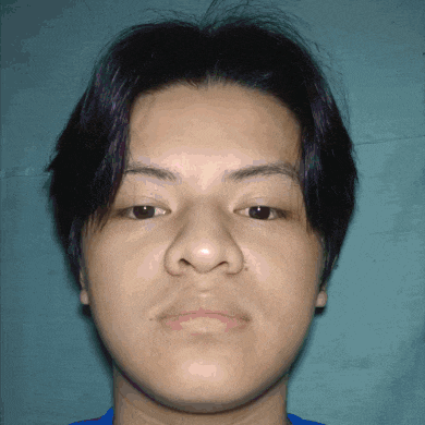 a close up of a young man 's face with a blue shirt on