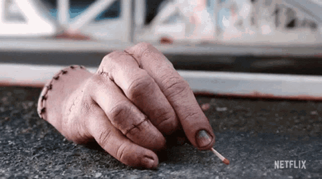 a hand with stitches on it is holding a match in its hand .